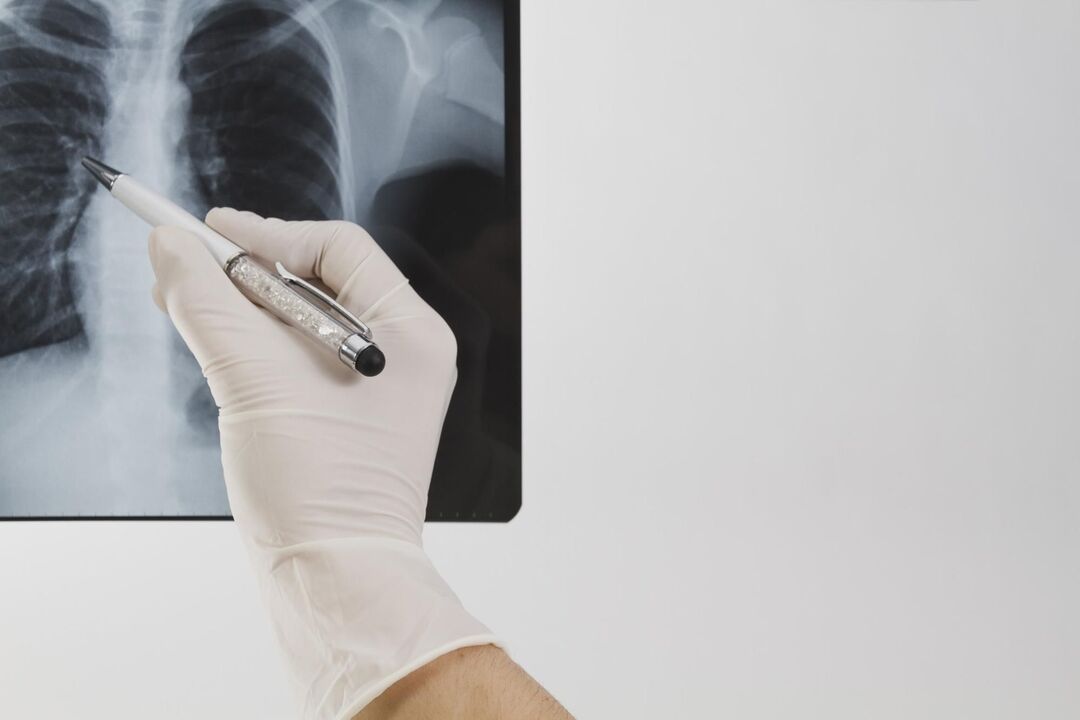 X-ray maka ịchọpụta osteochondrosis