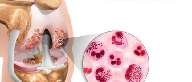 nke na-eduga na mmepe nke akpịrị