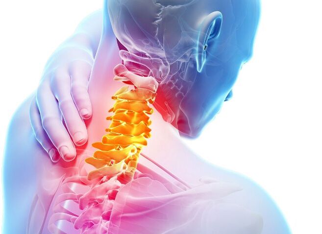 Mgbaàmà na nkebi nke mmepe nke osteochondrosis cervical