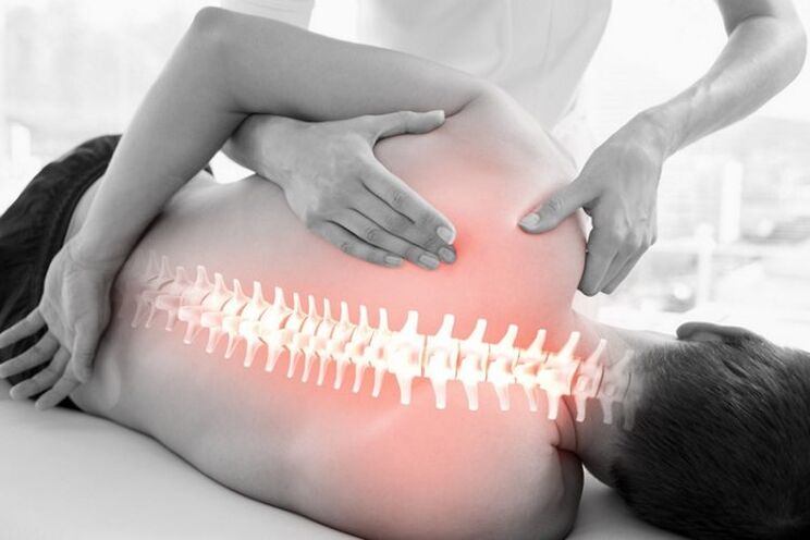Usoro ọgwụgwọ ntuziaka maka osteochondrosis nke spine thoracic
