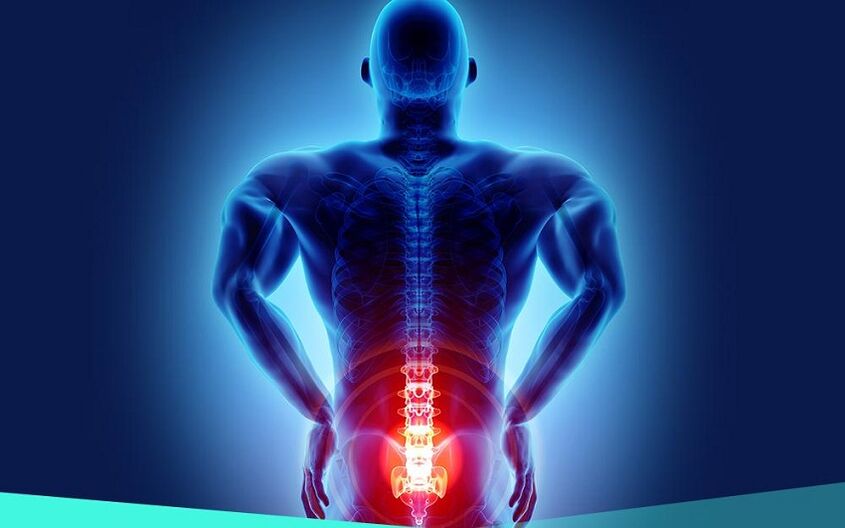 mgbu n'ihi hip arthrosis
